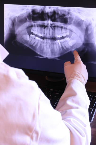Best Emergency Treatment for Oral Infections in Bellflower, CA