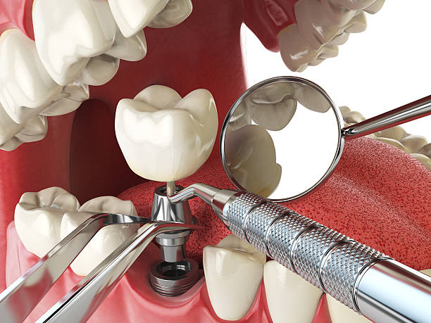 Best Emergency Treatment for Jaw Pain or Injury in Bellflower, CA